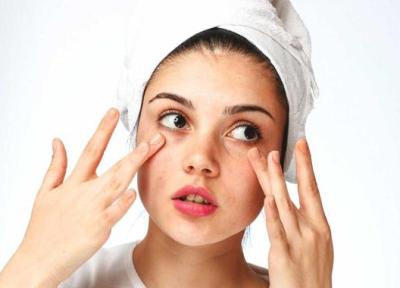راهکارهای کاربردی برای درمان خشکی پوست دور چشم که باید بدانید